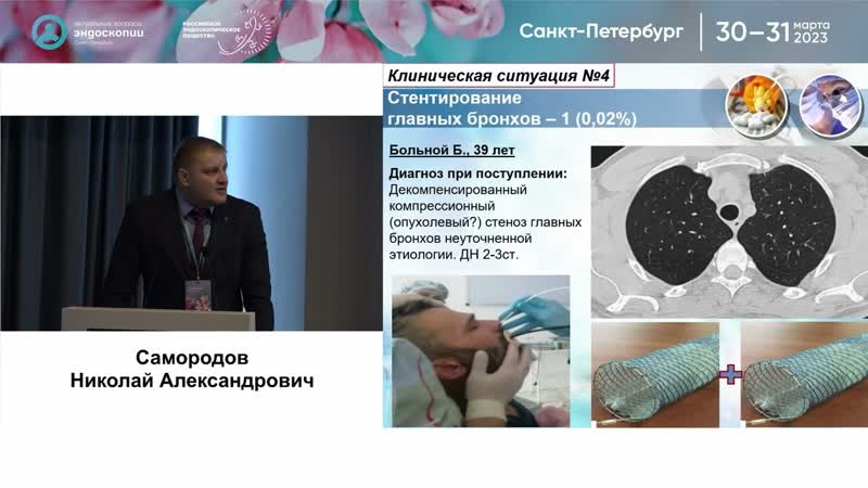Неформат в бронхологии: редкие и нетипичные ситуации в