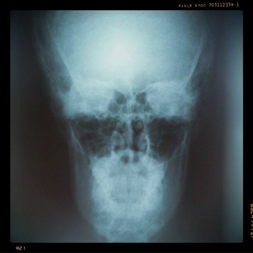 Alexander Smetanin | Санкт-Петербург