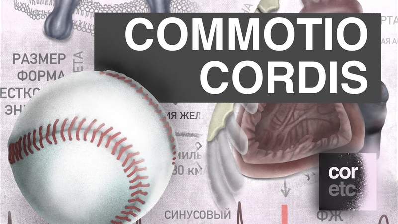 Commotio