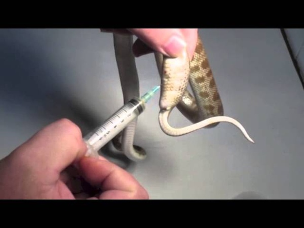 Egg removal Pt 2 the Aspiration